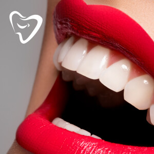 MICRO DISEÑO DE SONRISA