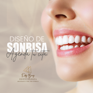 Diseño de Sonrisa en Resina de Alta Estética 10 DIENTES